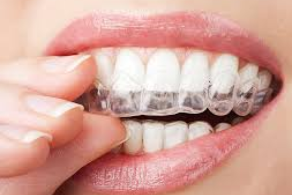 teeth whitening